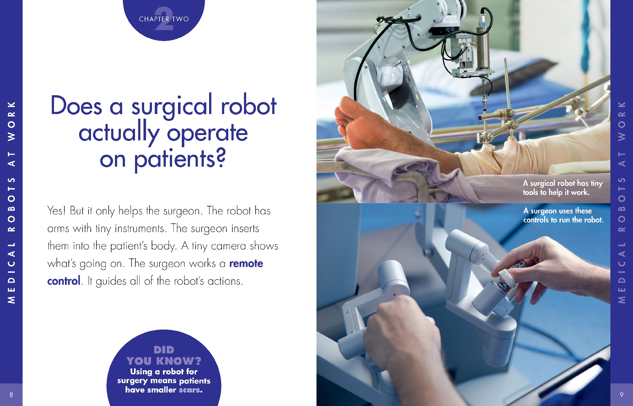 Curious about Medical Robots